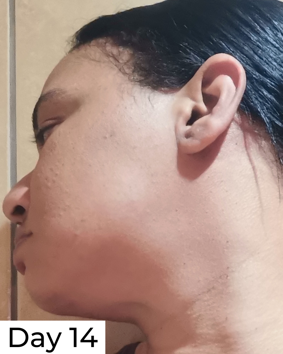 Hypochlorous Acid Daily Spritz - 175ml - Image 4