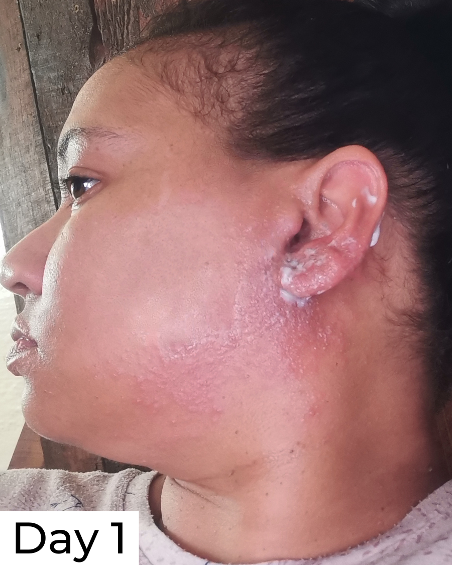 Hypochlorous Acid Daily Spritz - 175ml - Image 3